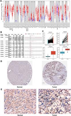 Prognostic Value and Immunological Role of KIFC1 in Hepatocellular Carcinoma